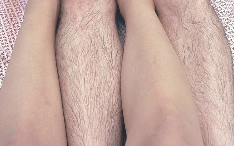 フォト2:アニュ a nu(烏丸御池/脱毛サロン)のフォト(写真)