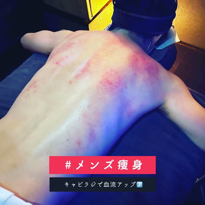 メンズ痩身(キャビテーション):Kelopak Bunga クロパブンガ(天神橋筋六丁目/リラクゼーション・脱毛)のフォト(写真)