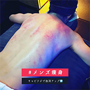 メンズ痩身(キャビテーション) Kelopak Bunga クロパブンガのフォト(小)